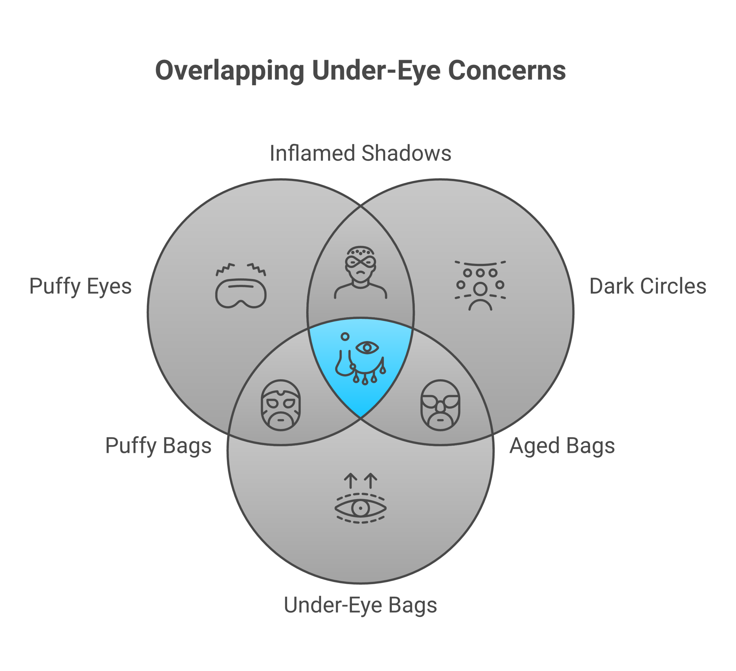 Infographic showing three under-eye concerns and their causes including puffy eyes from fluid retention, dark circles from thin skin, and bags from fat pad descent